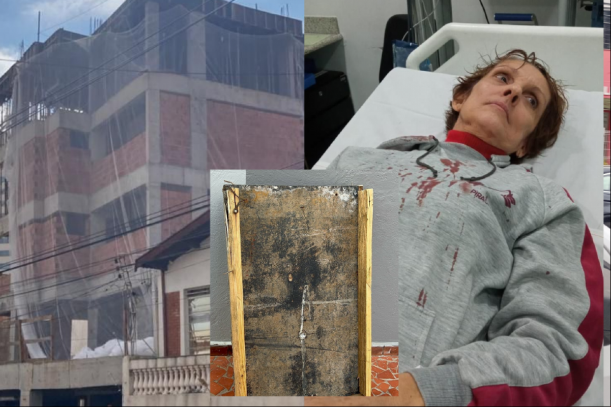 A fisioterapeuta Érica Rodrigues levou quatro pontos na cabeça no hospital.